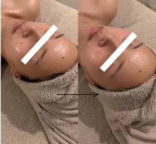 POLA THE BEAUTY 天王寺店所属・UEDA | POLA 天王寺のエステ・リラクイメージ