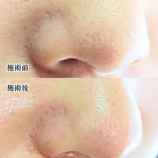  毛穴洗浄・まつ毛 の専門店 ソラーレのエステ・リラクイメージ