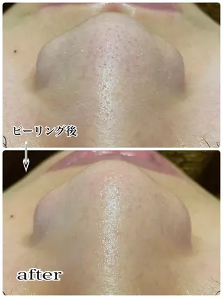 ENCHANT 脱毛.小顔.毛穴のエステ・リラクイメージ