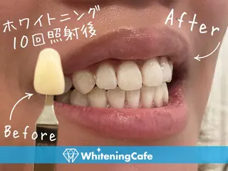 ホワイトニングカフェ徳島沖浜店所属・ホワイトニングカフェ 徳島沖浜店のエステ・リラクイメージ