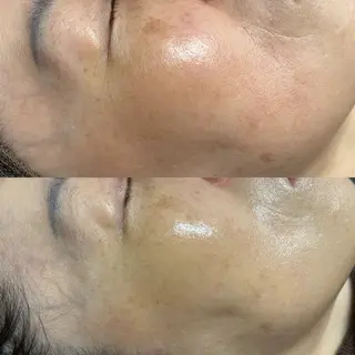 Lilyboo 池袋のエステ・リラクイメージ