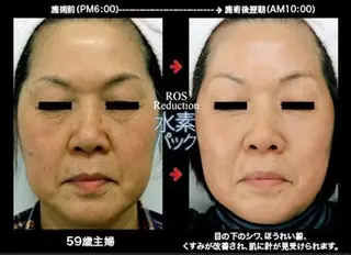 マドンナ 富士店のエステ・リラクイメージ