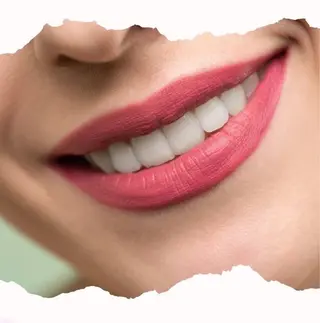 ホワイトニングショップ伊丹店所属・ホワイトニング ショップ伊丹店のその他イメージ