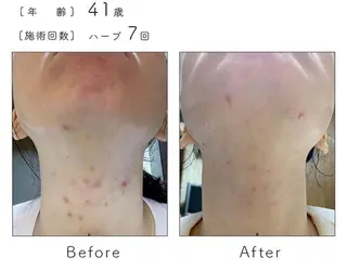 ハーブピーリング専門 BIOEL横浜のエステ・リラクイメージ