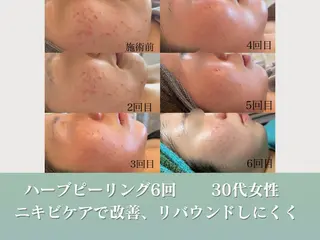 潤い艶肌/肌質改善 YUKAのエステ・リラクイメージ