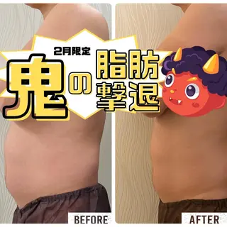 次世代痩身 人生最後のダイエットのエステ・リラクイメージ