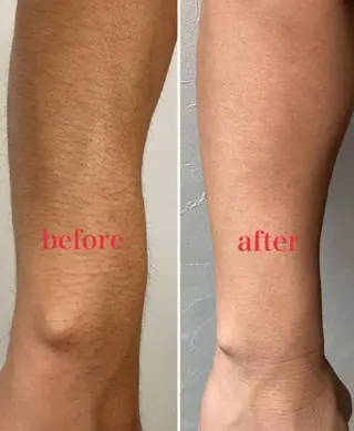 メンズ 姫路御立脱毛サロンSClass.所属・姫路御立脱毛サロン S Class.のエステ・リラクイメージ