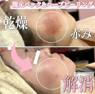 SALON所属・SALON韓国肌管理 東別院のエステ・リラクイメージ