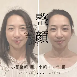 小顔×肌質改善サロン soin〔ソワン〕のエステ・リラクイメージ