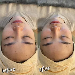 うなじ脱毛/美肌脱毛 LABELのエステ・リラクイメージ