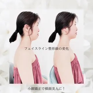 meishinkyu所属・小顔矯正  小林 香織のエステ・リラクイメージ