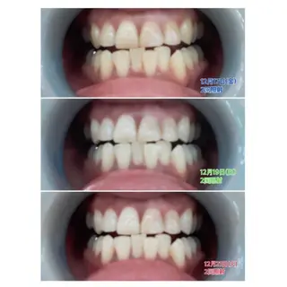 M渋谷店所属・Ｍ渋谷 ホワイトニングのその他イメージ