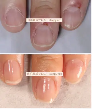 スリーピーオーブ所属・自爪育成眠れるサロン スリーピーオーブしずのネイルデザイン