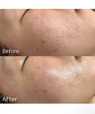 MINOA所属・MINOA 井上🌷のエステ・リラクイメージ