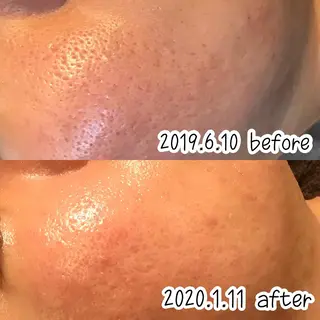 浜野 恵美のエステ・リラクイメージ