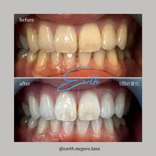 ホワイトニングサロン EARTH目黒店のその他イメージ