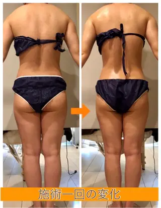 ロング カラー パーマ ヘアアレンジ メンズ キッズ ネイル マツエク・マツパ ‍痩身＆ボディ 結果出し🌟丹野のエステ・リラクイメージ