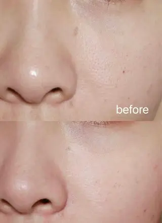 ネイル aliaハイフ&水光ジェットサロン所属・aliaハーブ水光店 エステティシャン募集のエステ・リラクイメージ