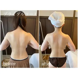 I'm -ｲﾑ-所属・肌質改善／ブライダル I'm.-イム-のエステ・リラクイメージ