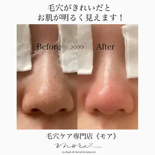 Eyelash salon MORE(モア)所属・安納 麻穂のエステ・リラクイメージ