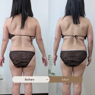 【痩身▪️体質改善ダイエット】美養サロンEnbi～縁美～所属・美養サロンEnbi ～縁美～のエステ・リラクイメージ