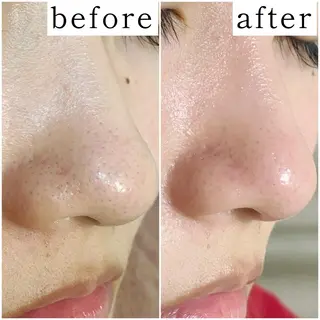 毛穴専門サロン　フルール所属・フルールFululu 自由が丘のエステ・リラクイメージ