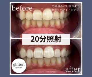 マツエク・マツパ glitter.SHONAN所属・ホワイトニング専門店 glitterのその他イメージ