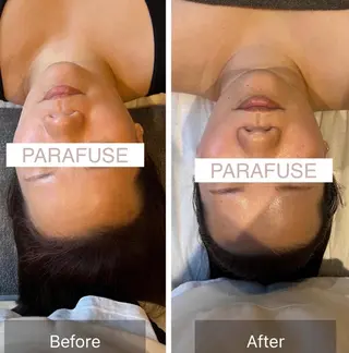 Belulu所属・Belulu ベルルのネイルデザイン