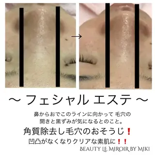 ビューティー ミロワールのエステ・リラクイメージ