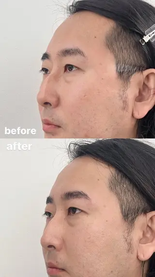 メンズ アイブロウ カルフールリル　草加所属・草加/ miyu 🫧の眉毛・アイブロウイメージ