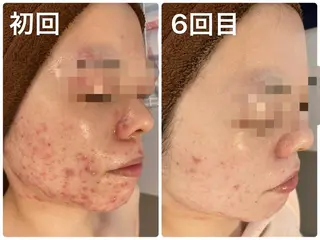 hm NATURESKINのエステ・リラクイメージ