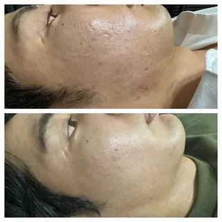 メンズ Mythica所属・ミシカ 横浜のエステ・リラクイメージ