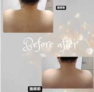 浮腫み，冷え性、 体質改善、のエステ・リラクイメージ