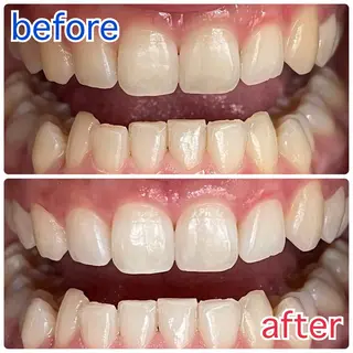 サクッとホワイト五反田店所属・セルフホワイトニング 五反田のその他イメージ