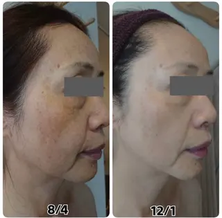 Esthe salon Blanche(エステサロンブランシュ)所属・小顔リフトアップ 美肌改善専門店のエステ・リラクイメージ