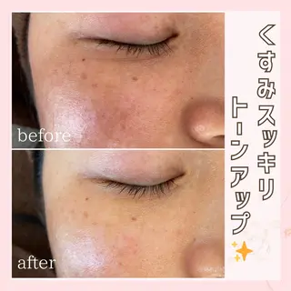 プライベートサロン クヴェルのエステ・リラクイメージ