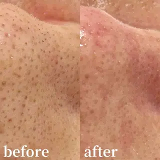 毛穴専門サロンLatiele所属・毛穴専門サロン Latieleのエステ・リラクイメージ