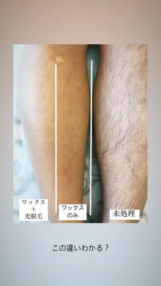 ワックス脱毛🌈 ESPOIRnocoのエステ・リラクイメージ