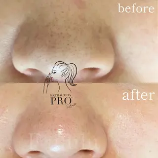 毛穴専門サロン　フルール所属・フルールFululu 自由が丘のエステ・リラクイメージ