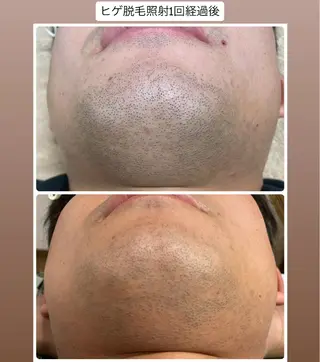 DISINI SPA所属・DISINISPA 脱毛/フェイシャルのエステ・リラクイメージ