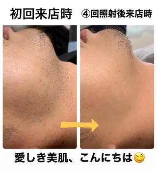 メンズ メンズ脱毛サロン Le falcoのエステ・リラクイメージ