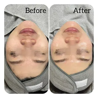 Éclat de Belle🫧白玉肌のエステ・リラクイメージ