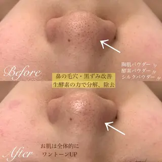 one day所属・肌質改善ハーブサロン ALA原宿のエステ・リラクイメージ