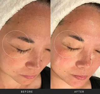 Lani Moon所属・⟡ 京都 小顔  ⊹ Lani Moonのエステ・リラクイメージ