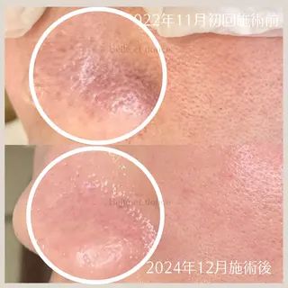 Belle et douce所属・毛穴ケア専門サロン ベルエドゥースのエステ・リラクイメージ