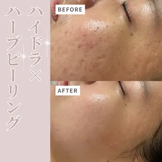 プライベートサロン Belle(ベル)のエステ・リラクイメージ