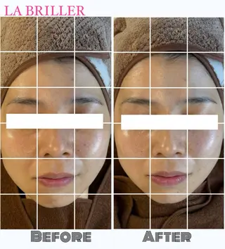 LA BRILLERのエステ・リラクイメージ