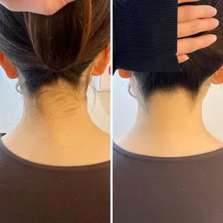 うなじ脱毛/美肌脱毛 LABELのエステ・リラクイメージ