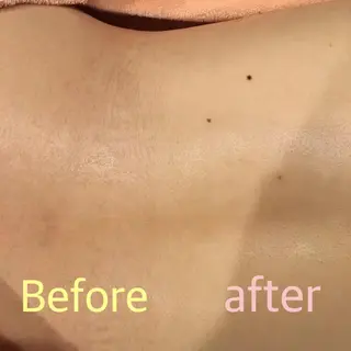 美肌脱毛専門店 ディオーネ四日市店のエステ・リラクイメージ