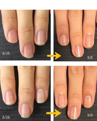 ネイル hana.nail 自爪育成サロンのネイルデザイン